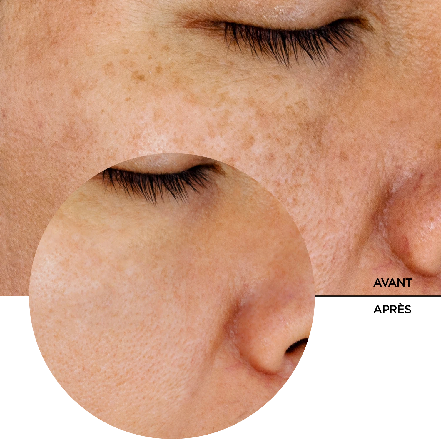 JUST Acide Glycolique 7% – Image 7