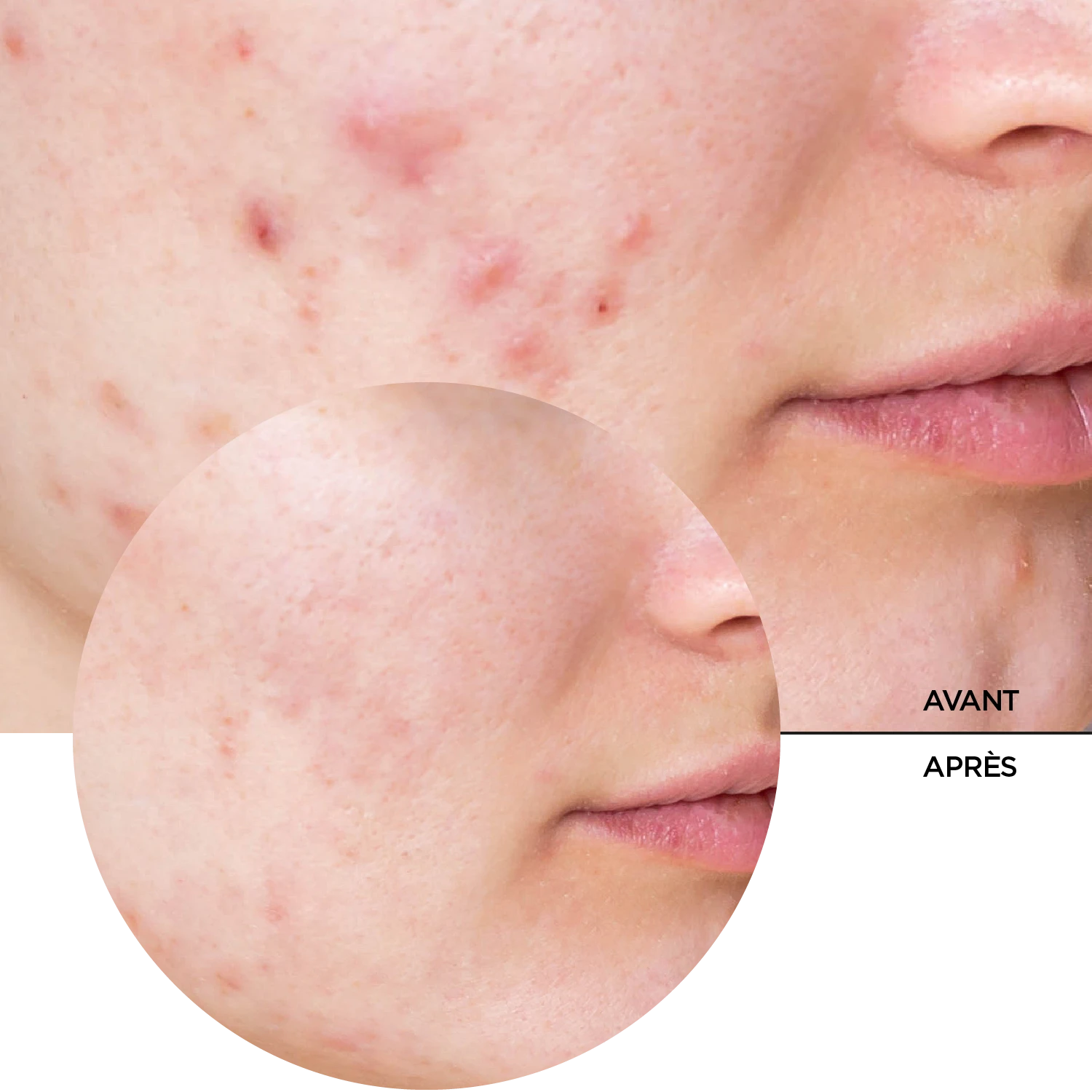 JUST Niacinamide 10% – Image 8