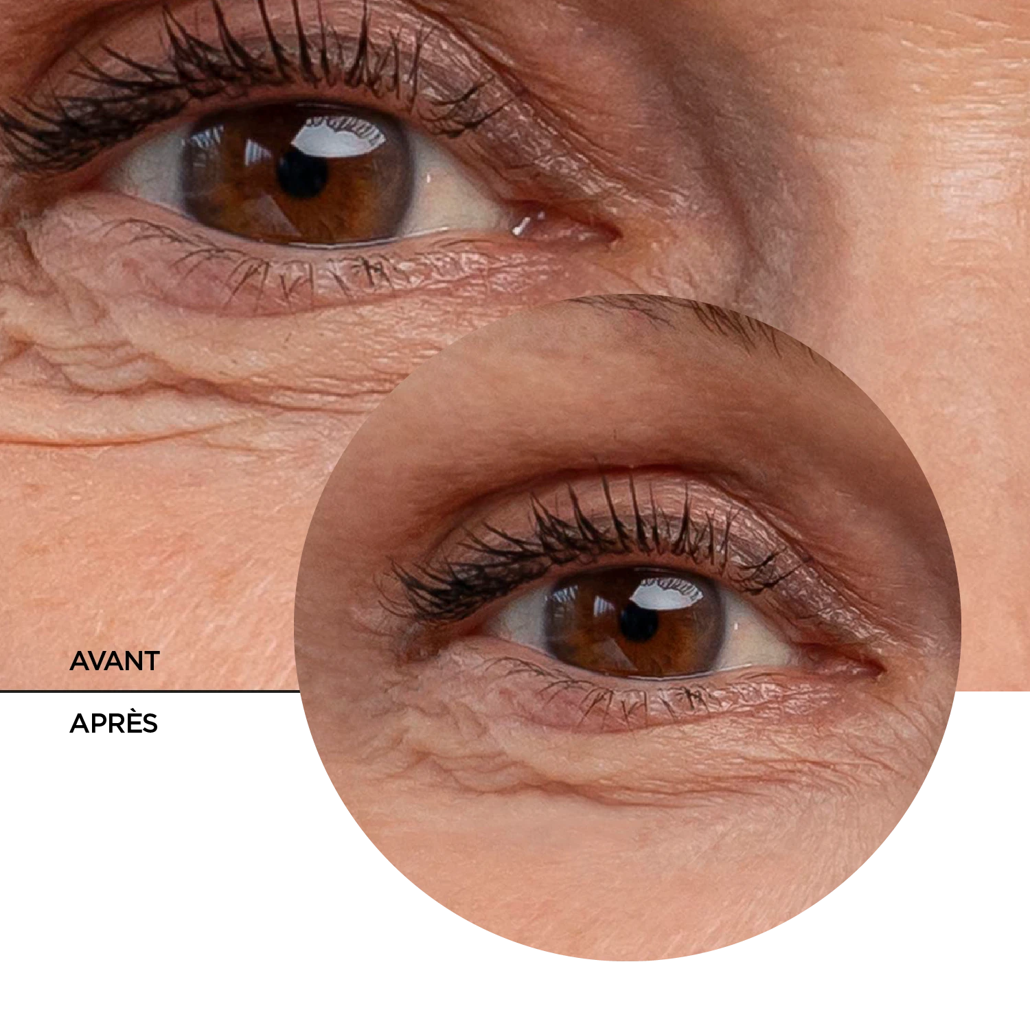 RETINOL Gel Yeux Concentré Anti-Rides – Image 8