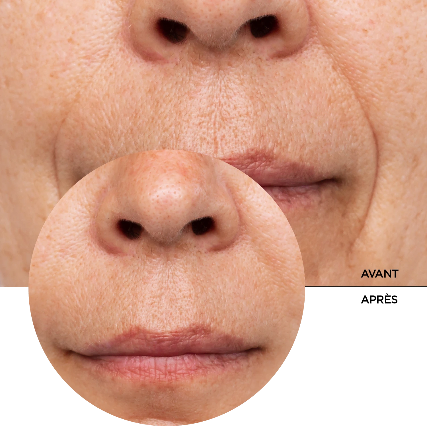 JUST Retinol in Squalane – Image 8