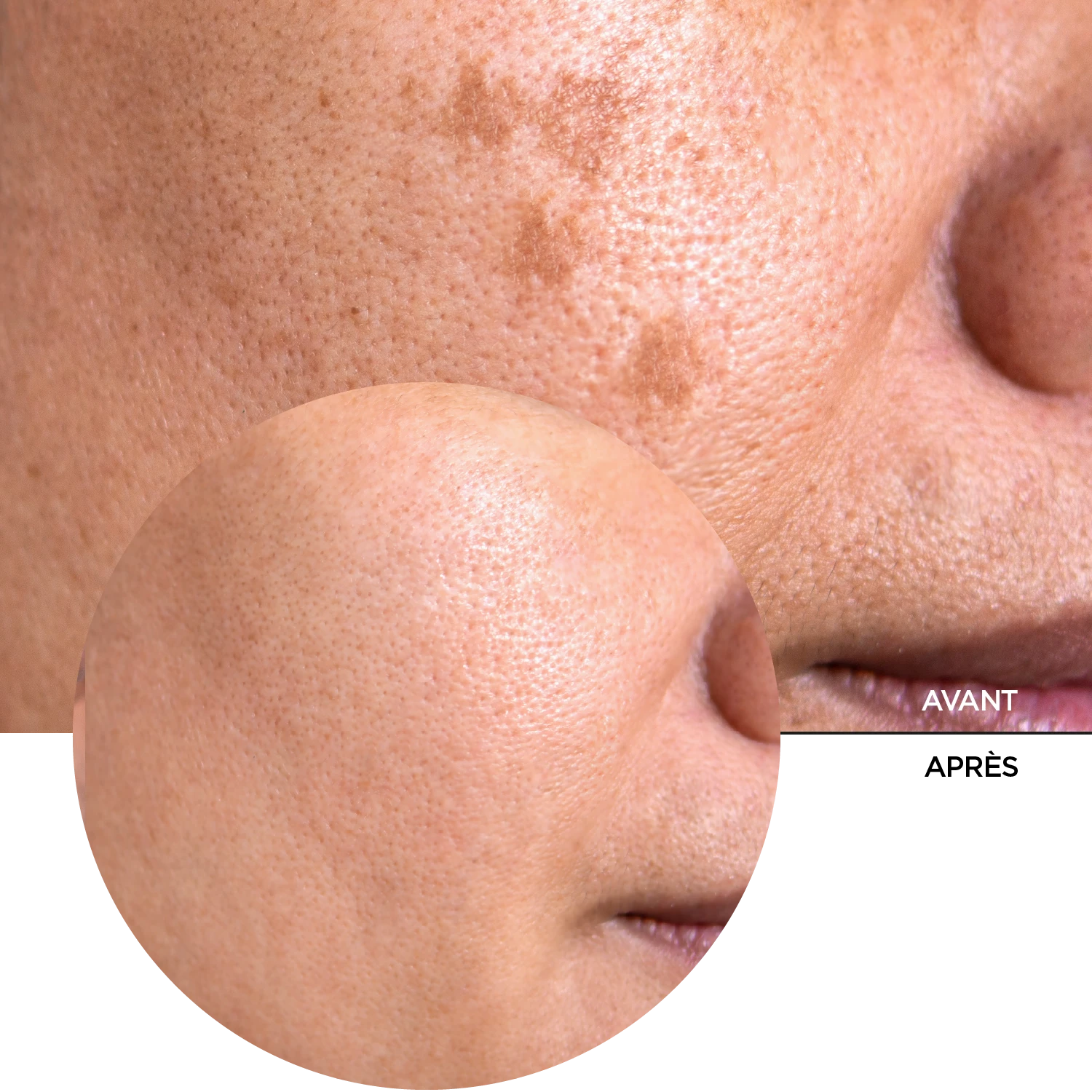 JUST Vitamine C 20% – Image 8