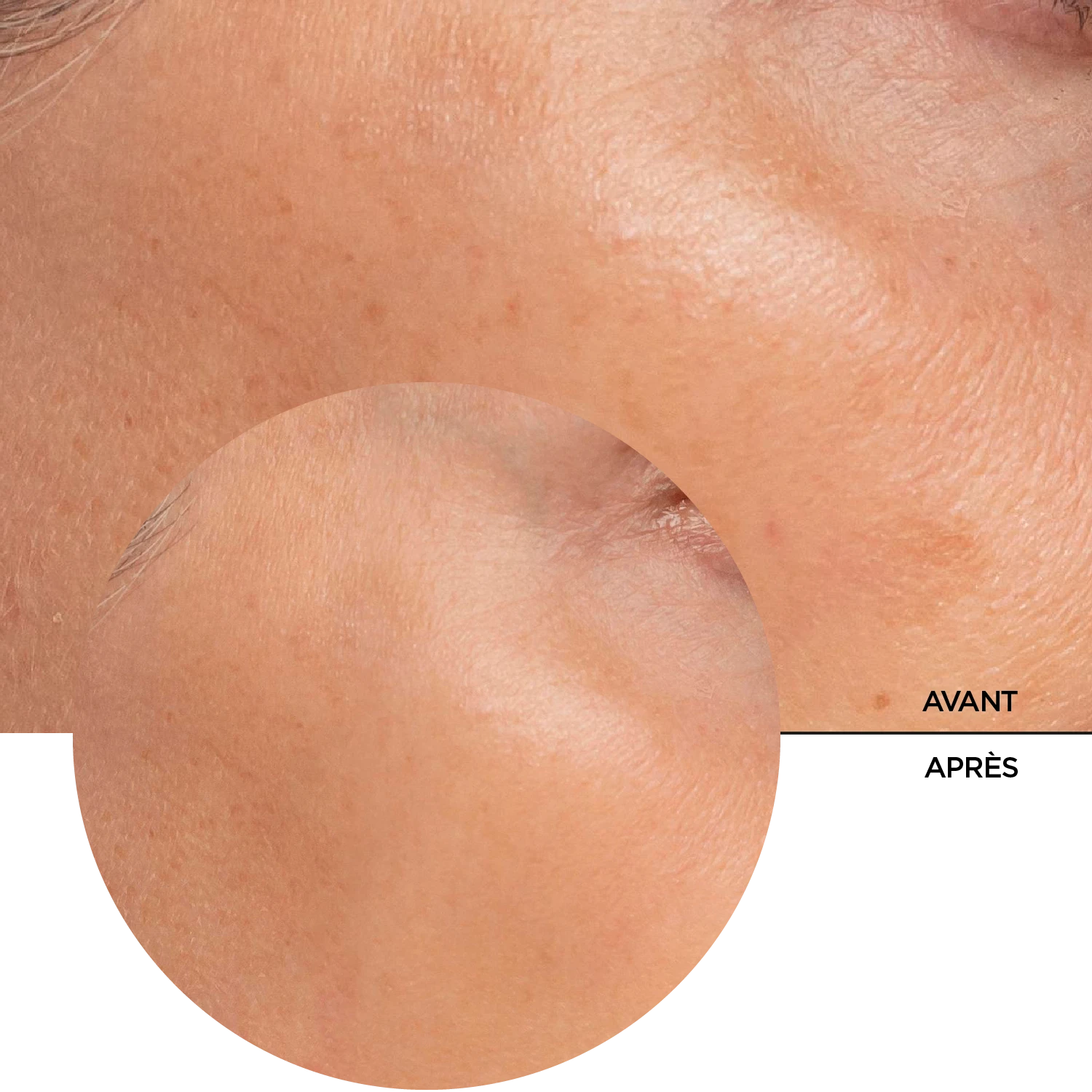 JUST ALPHA ARBUTIN 2% + HA BRIGHTENING SERUM, 30ml – Image 7