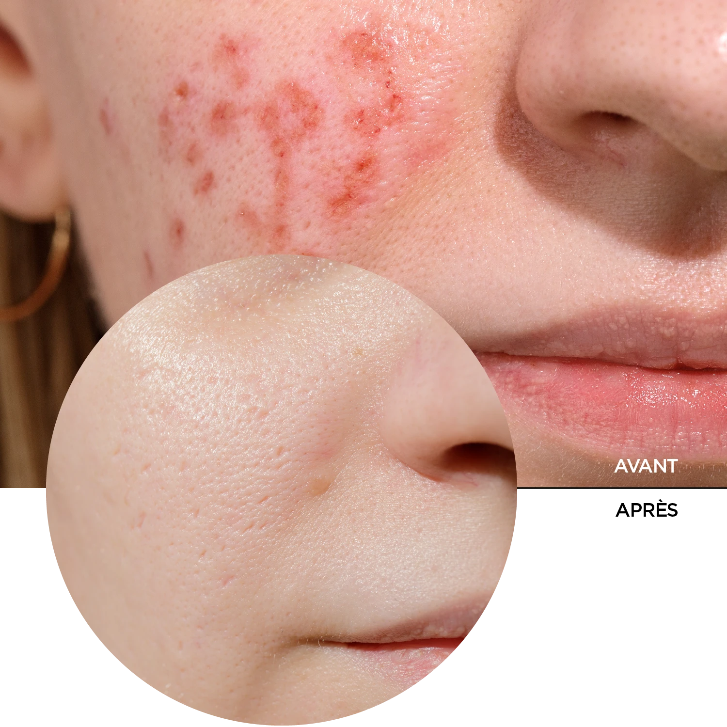 JUST VITAMIN C 2% SUSPENSION ILLUMINATING MOISTURIZER 30 ml – Image 7