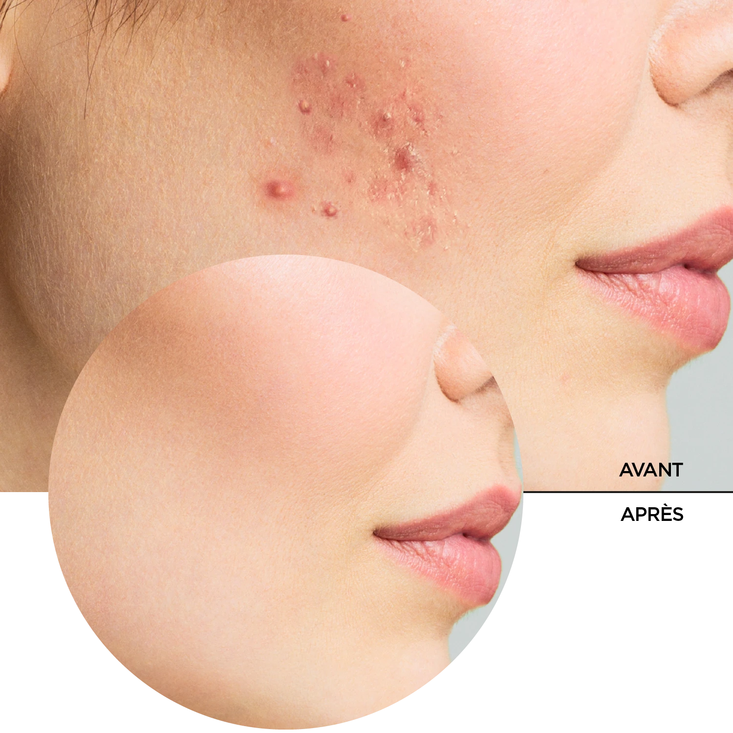 ZITCARE AHA.BHA.PHA. ACTIVE FACE TONER, 250ml – Image 8