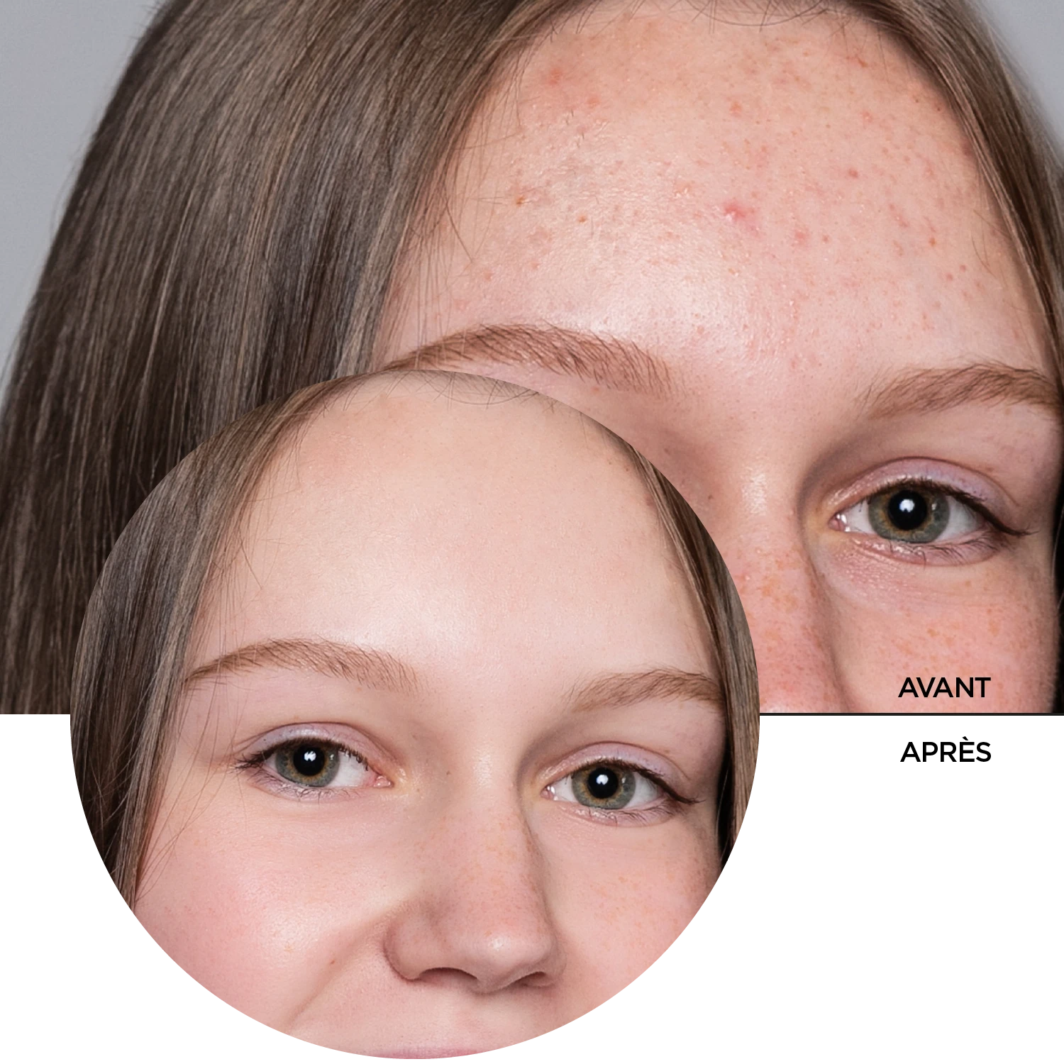 ZITCARE AHA.BHA.PHA. FACE WASH, 250ml – Image 7