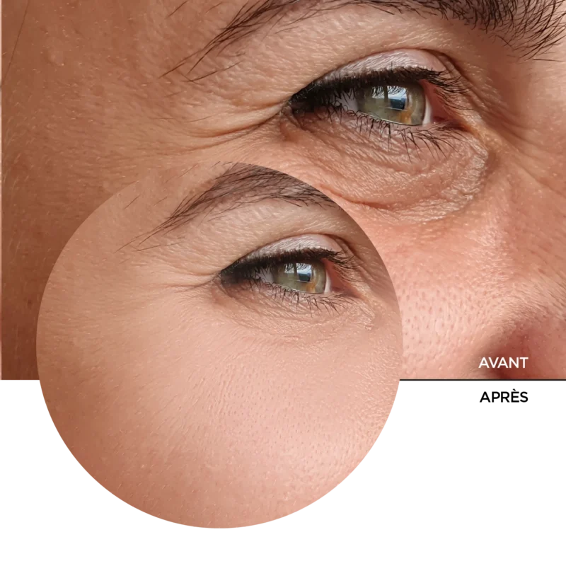 Retinal 0,2% Fluide – Image 8