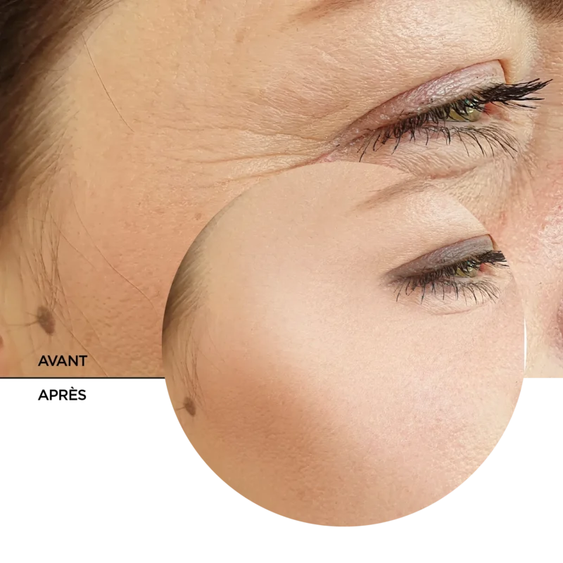 JUST RETINOL 0.3% + NIACINAMIDE 5% – Image 8